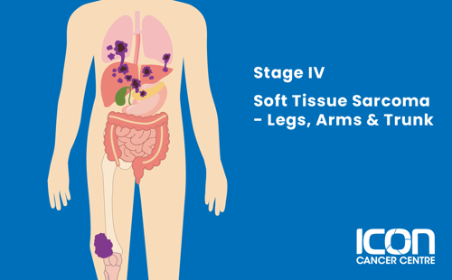 Stage IV soft tissue sarcoma in arms, legs and trunk illustration
