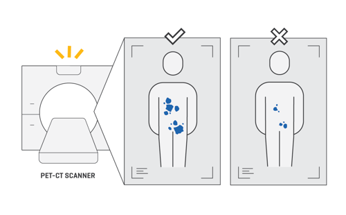 Illustration of scanning in a PET-CT machine