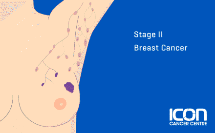 Stage 2 Breast cancer