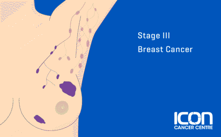 Stage 3 Breast cancer