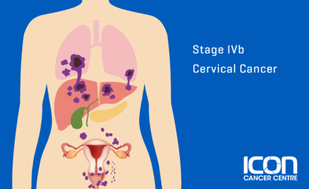 Stage 4b Cervical Cancer