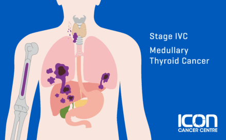 Stage 4c medullary thyroid cancer