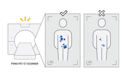 Step 3 PSMA Diagnostics