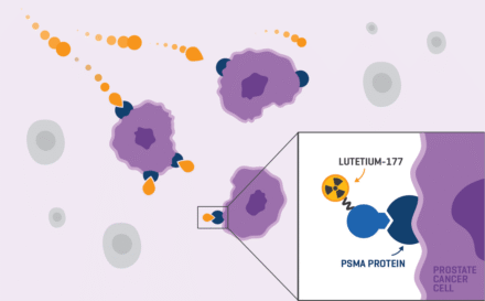 Step 2 PSMA Therapeutics