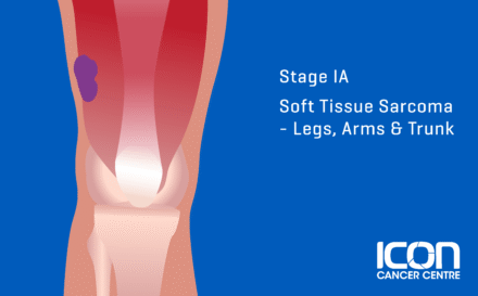 Stage 1a soft tissue sarcoma in the arms, legs and trunk