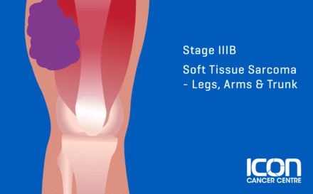 Stage 3b soft tissue sarcoma